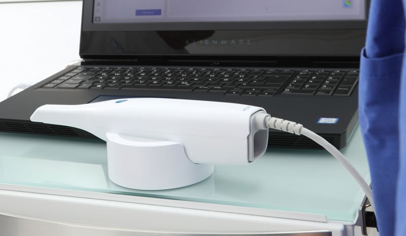 Intraoralscanner